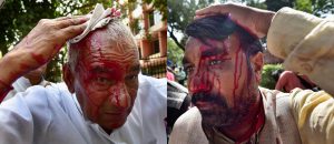 New Delhi: INLD members who sustained injuries after security personnels charged them during their protest 'Gherao the Parliament' seeking PM Narendra Modi's intervention on the SYL canal issue. PTI Photo by Manvender Vashist (PTI3_15_2017_000203B)